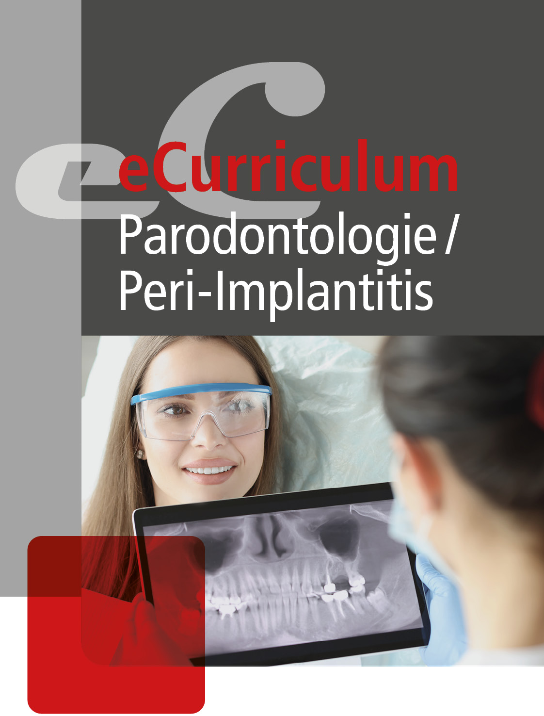 Parodontologie / Peri-Implantitis 