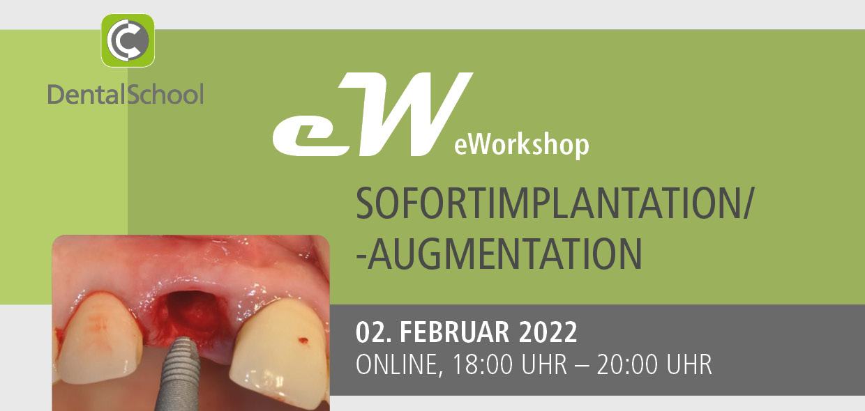 Sofortimplantation/-Augmentation